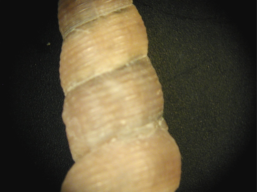 Mesalia mesal e Mesalia  brevialis?